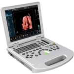 3D/4D/5D Laptop Color Doppler Portable Ultrasound Scanner