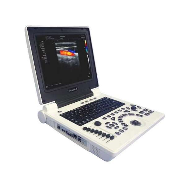 Notebook B/W Portable Ultrasound Machine MYXF-P20