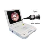 Portable HD Endoscopy Unit