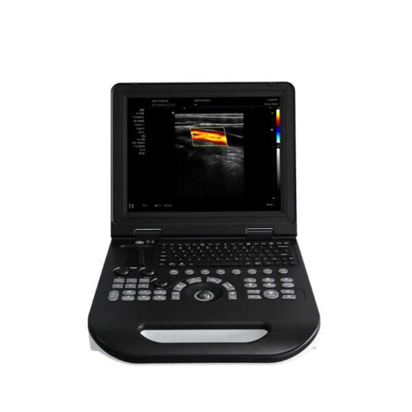 Notebook Color Doppler MDW-XFE30