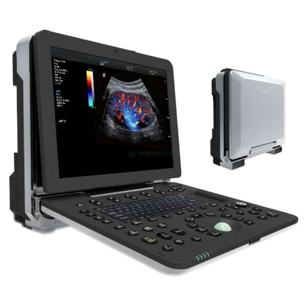 4D Portable Robust Cardiovascular Ultrasound Equipment