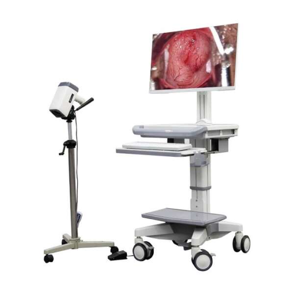 OM-6650-1 Colposcope Colposcopy Digital Imaging Processing System