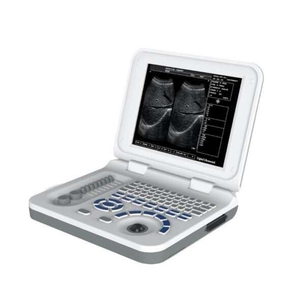 Full Digital LED Laptop Ultrasound Machine MYXF-S30