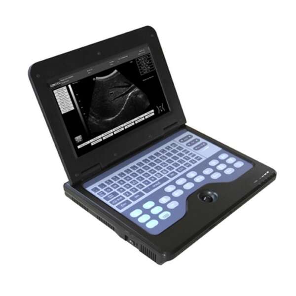 KT-CMS600P2 B-Ultrasound Diagnostic System